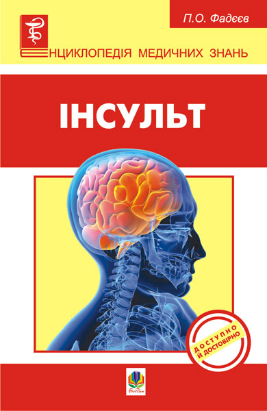 Інсульт