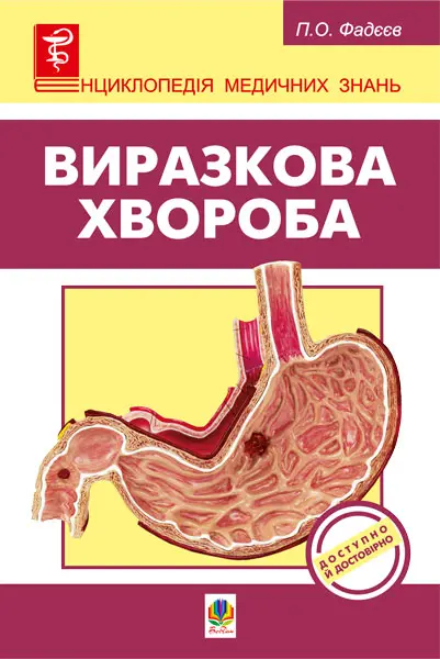 Виразкова хвороба